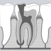L'endodontie