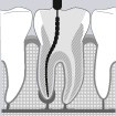 L'endodontie